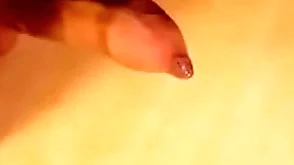 Phimosis blarney great cumshot