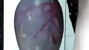Famous insertion gapes his ass